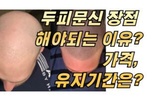 두피문신 장점 해야되는 이유? 가격, 유지기간은?