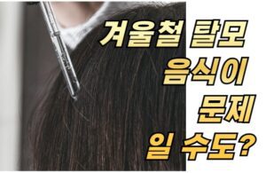 겨울철 탈모, 음식이 문제일 수도?